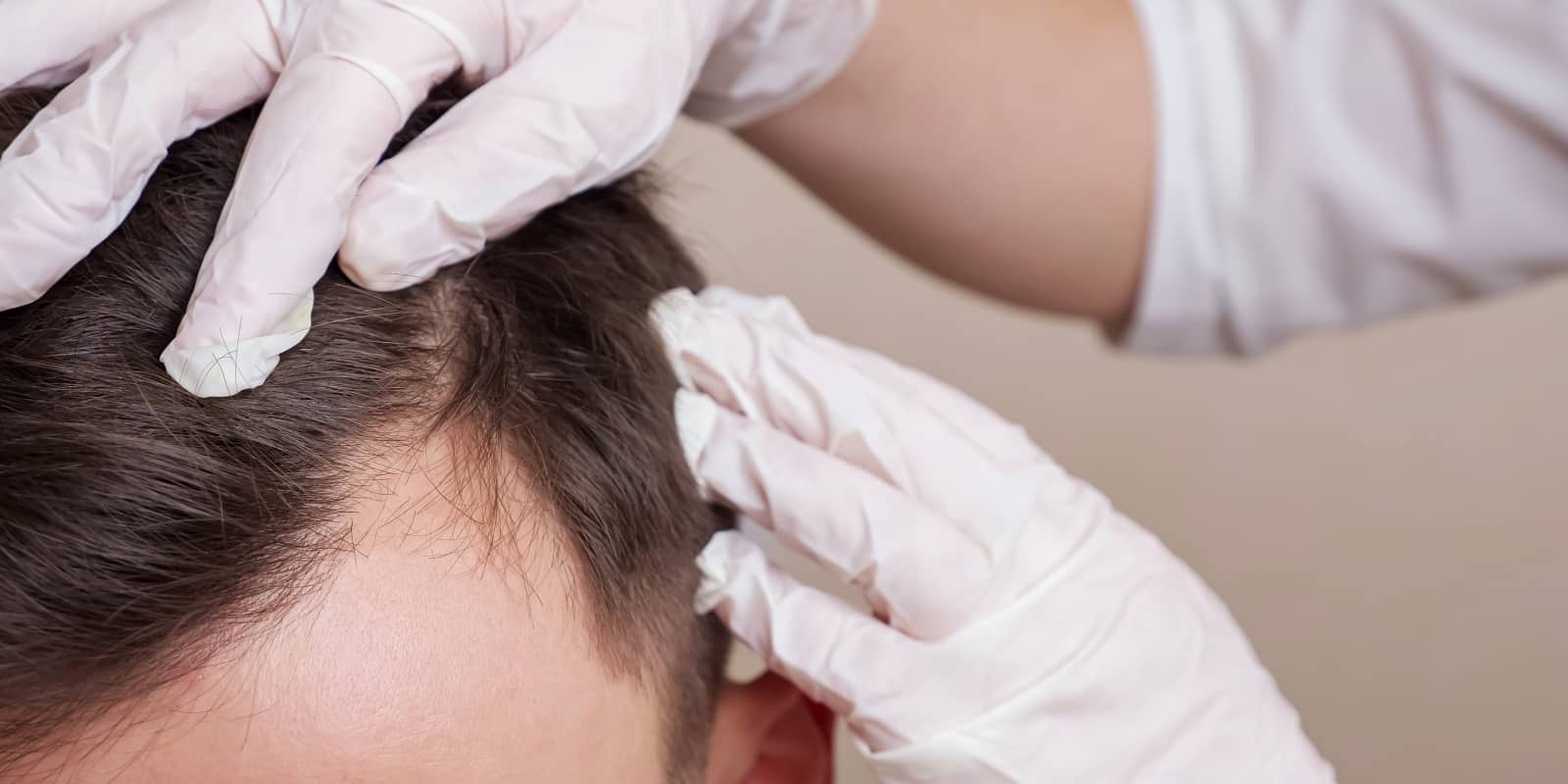 To gain a deeper understanding of your scalp's condition, consider getting a professional scalp assessment.
