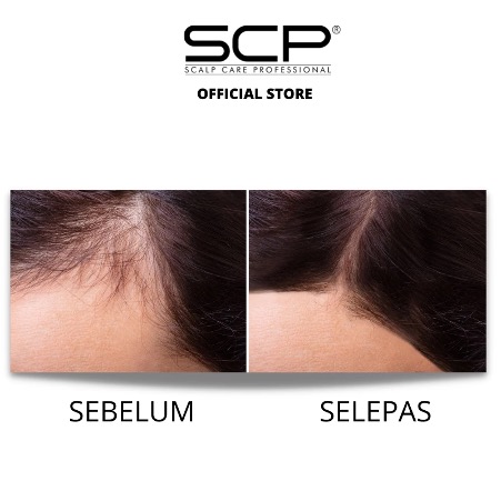 How to Use Hair Tonic Correctly