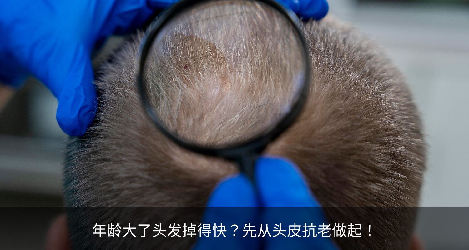 年龄大了头发掉得快？先从头皮抗老做起！